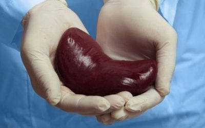Kidney Transplantation – Important Facts to Know